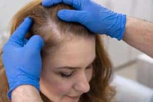Trattamento medico per la crescita dei capelli, con professionista che esamina il cuoio capelluto.