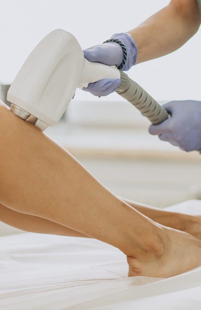 Laser terapia per cellulite su coscia e gamba.