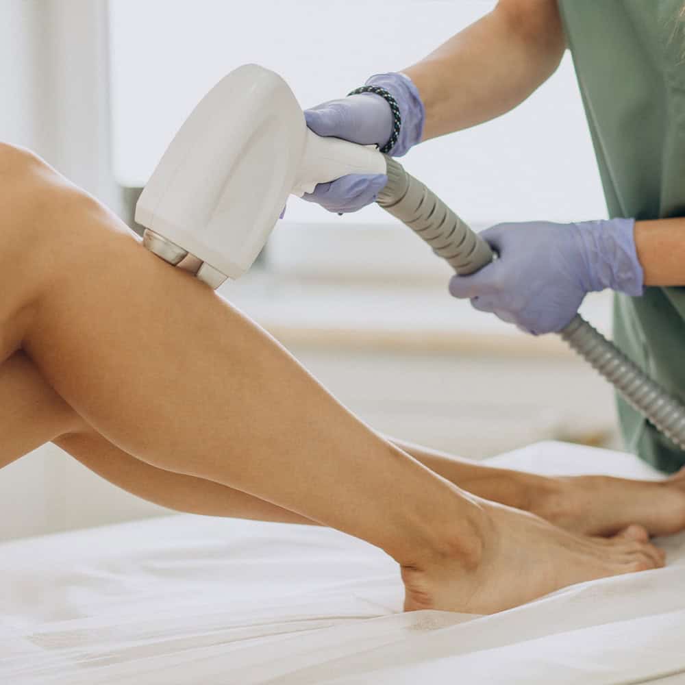 Laser terapia per cellulite su coscia e gamba.