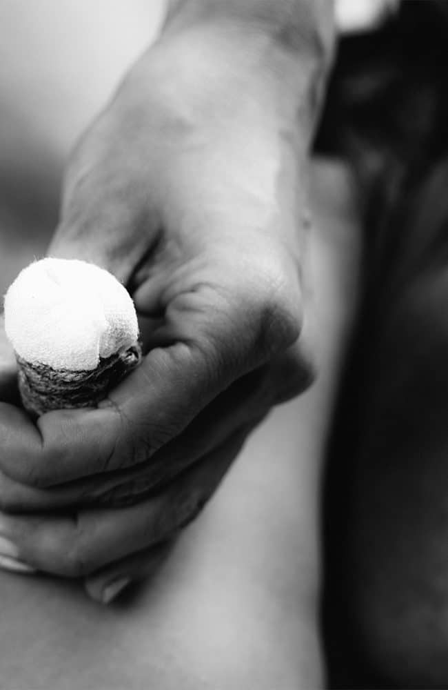 Pulsante di fleboterapia con ago e siringa, trattamento medico per problemi vascolari.